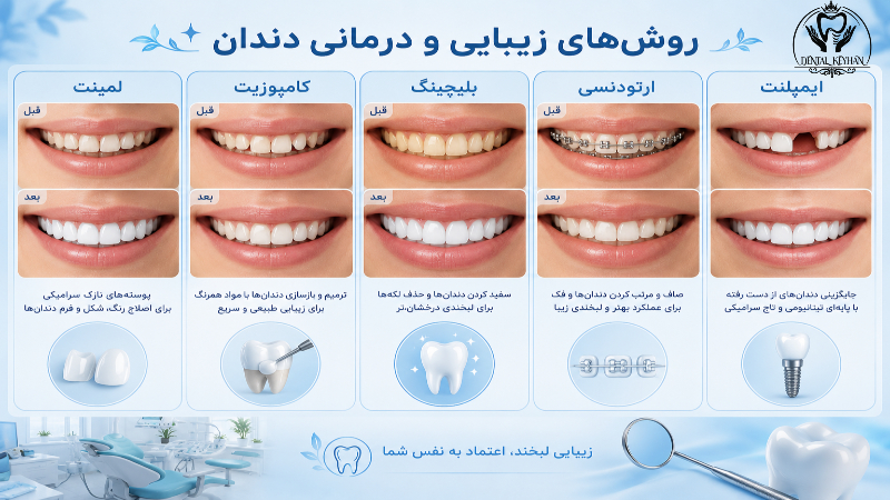 مقایسه لمینت، کامپوزیت، بلیچینگ و سایر روشهای زیبایی دندان