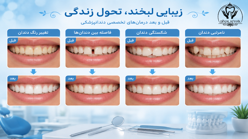 انتخاب درمان زیبایی مناسب برای مشکلات مختلف دندان