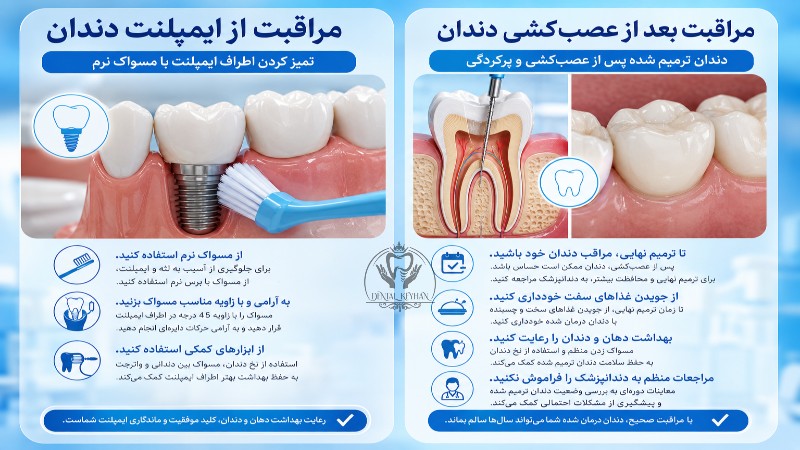مسواک نرم در حال تمیز کردن اطراف ایمپلنت دندان و دندان ترمیم شده پس از عصبکشی و پرکردگی